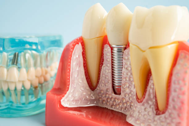 Professional Dental Services in Wheat Ridge, CO